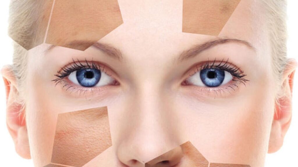 Deri Üzerinde Beyaz Lekelerin Oluşumu ve Sebebi Nedir? 7 b2ap3 large cilttt